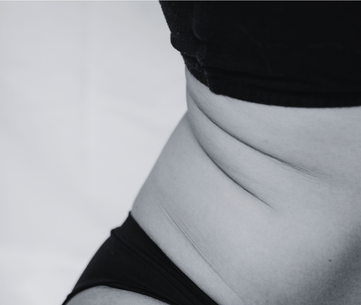 Acupuncture for Women’s Health in San Diego