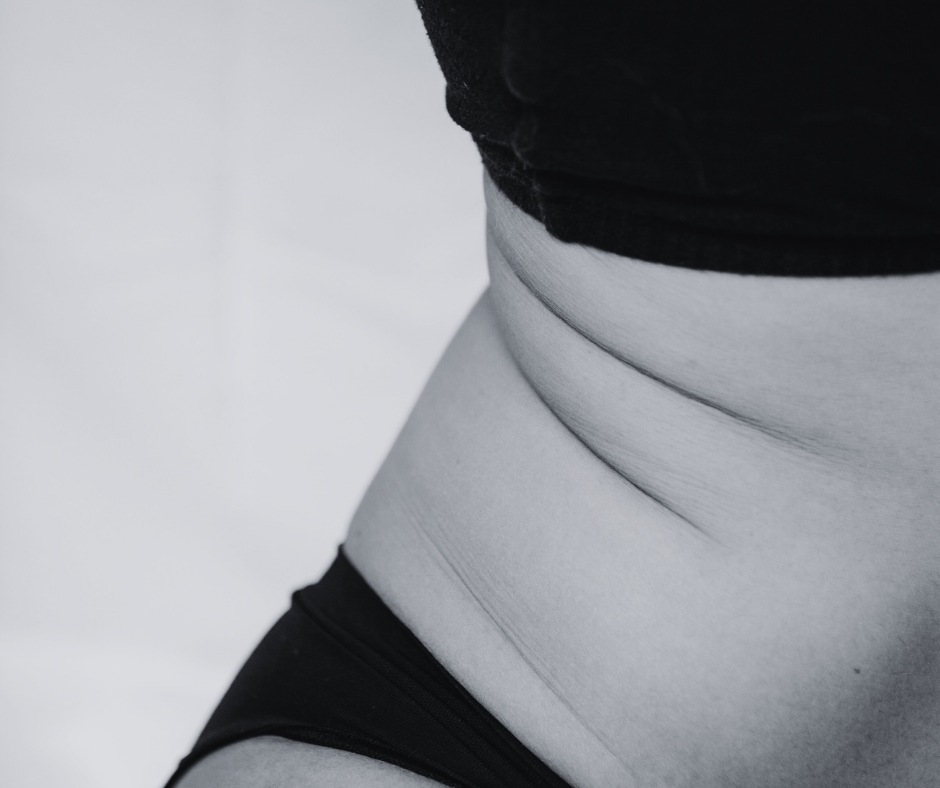 How Fertility Acupuncture Is Customized by Diagnosis