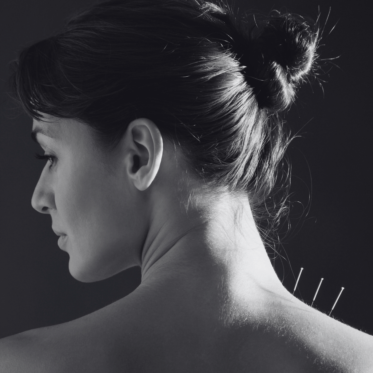 acupuncture for iui san diego fertility