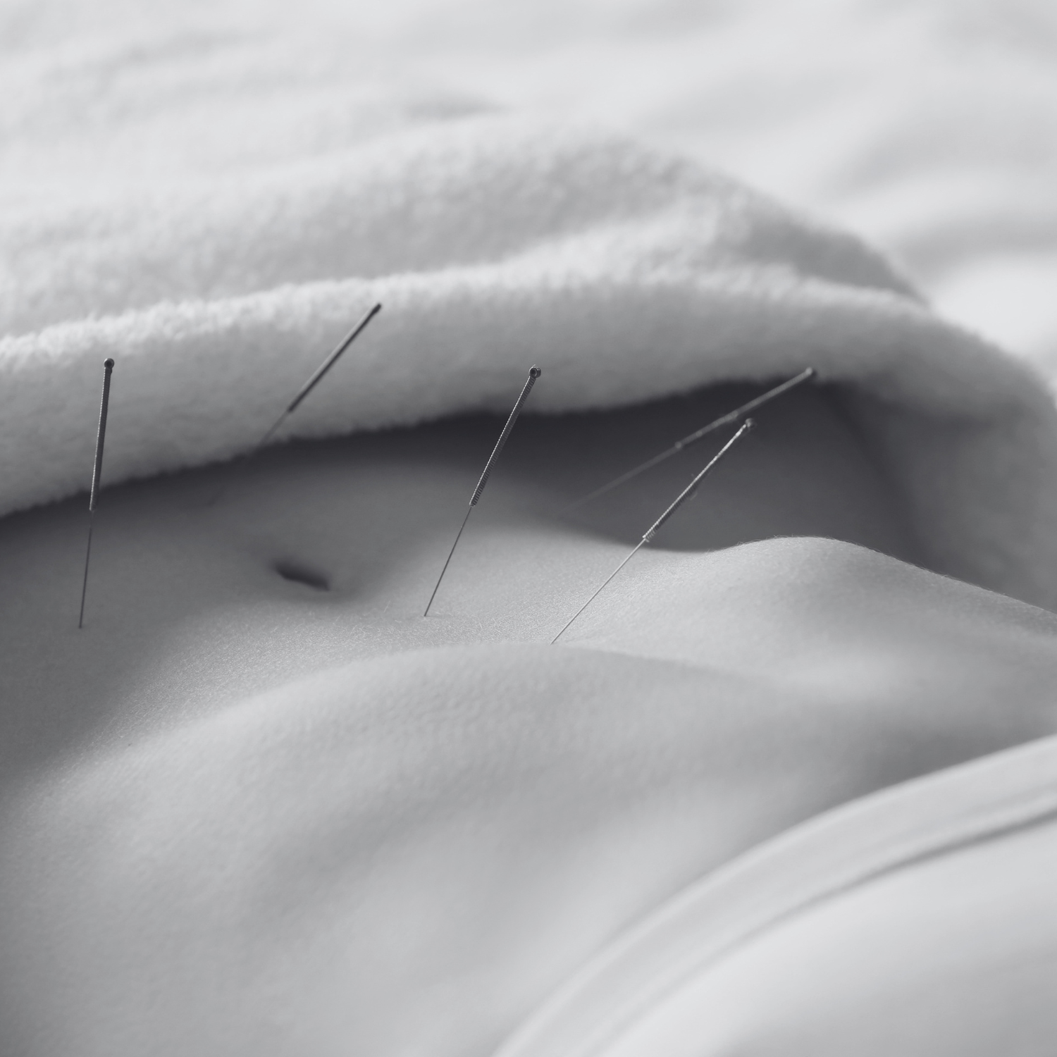 Managing IVF symptoms San Diego